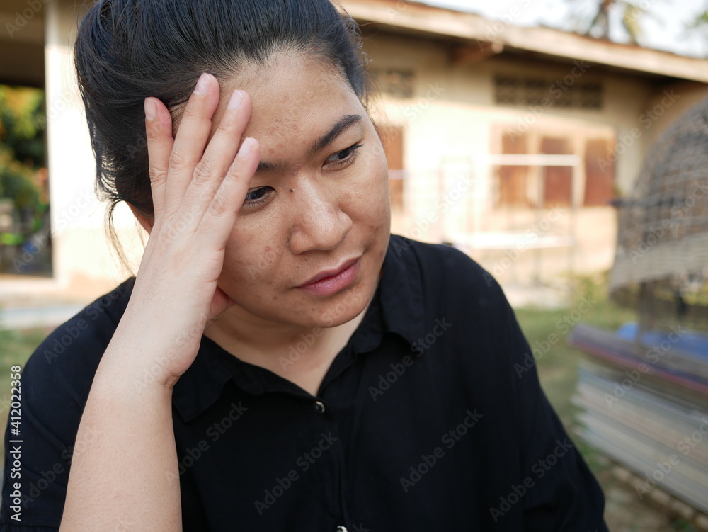 Portrait of asian woman have headache due to stress.