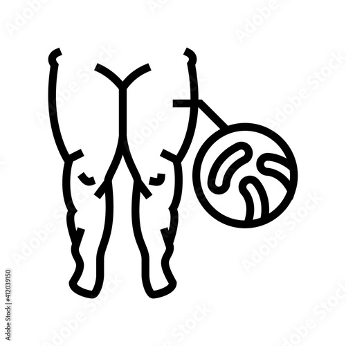 fatty edema line icon vector. fatty edema sign. isolated contour symbol black illustration