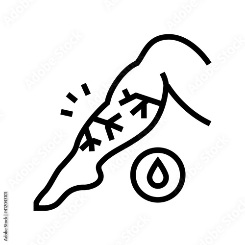 venous edema line icon vector. venous edema sign. isolated contour symbol black illustration