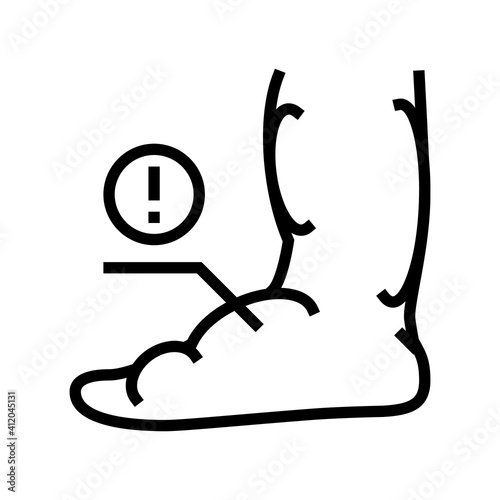 leg edema critical leg health problem line icon vector. leg edema critical leg health problem sign. isolated contour symbol black illustration
