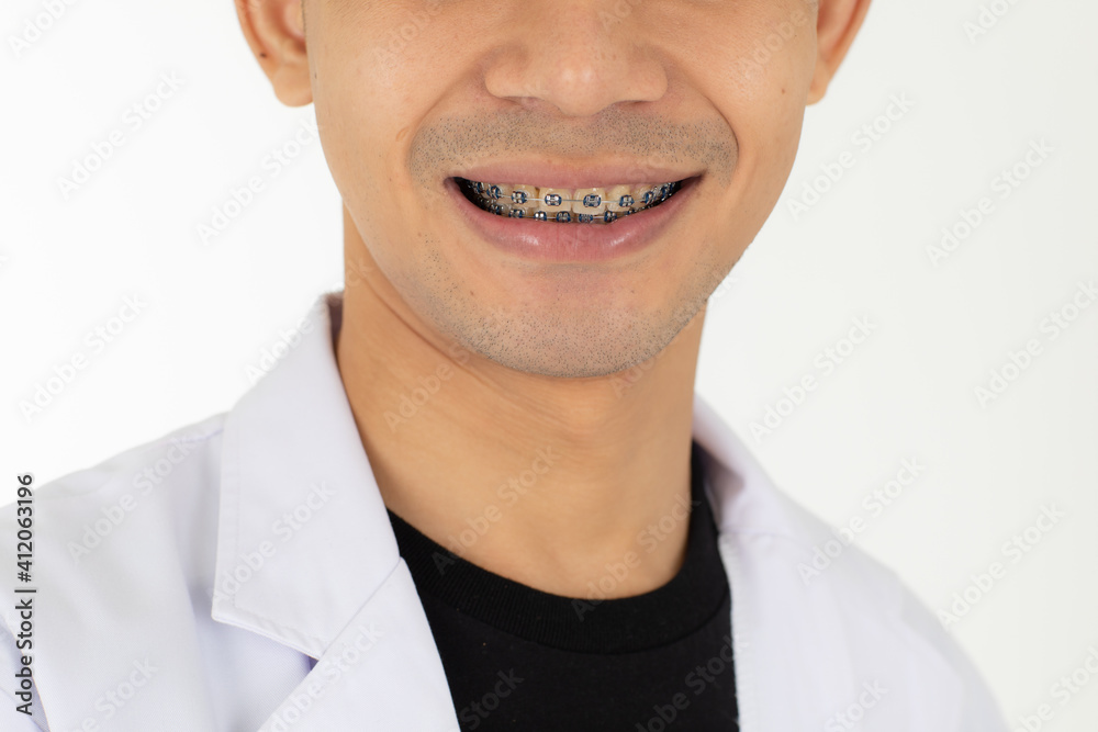 A young and handsome Asian teen man smiling to show the good tooth with a brace. Isolated on white background A young and handsome Asian teen man smiling to show the good tooth with a brace. Isolated on white background