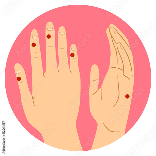 Hand Tapping Points Illustration