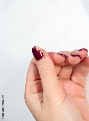 Chipped gel polish coating on the thumb. Close-up. White background.
