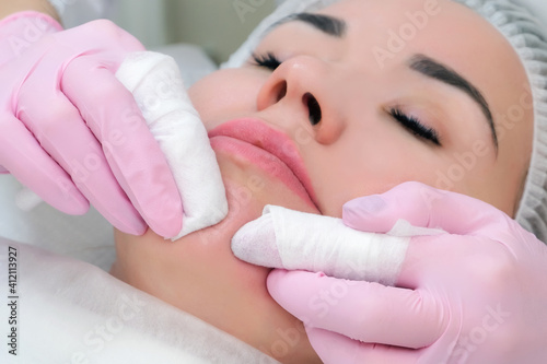 procedure for manual cleansing of the facial skin from blackheads and acne.