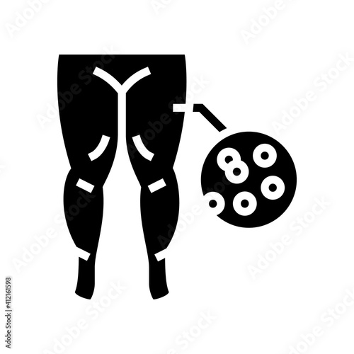 hypoproteinemic edema glyph icon vector. hypoproteinemic edema sign. isolated contour symbol black illustration