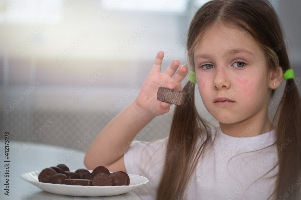 A little girl with an allergic rash on her cheeks sits at a table next