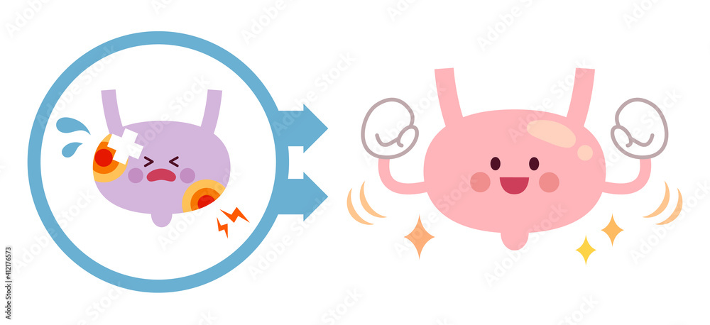 Obraz premium 不健康な膀胱から健康な膀胱になるビフォーアフター