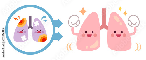 不健康な肺から健康な肺になるビフォーアフター