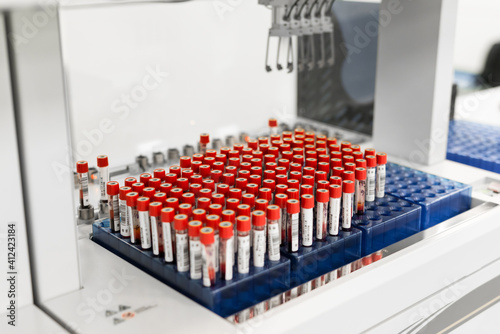 A row of human blood and chemistry samples awaiting testing in the lab photo