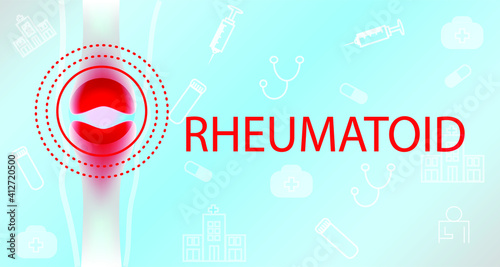 Illustration of Rheumatiod arthritis, Joint pain. Wrist pain.