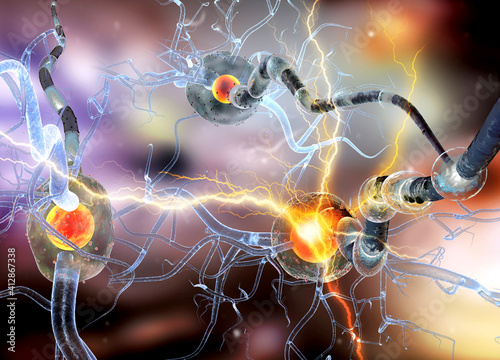 3d illustration of nerve cells, neurons, concept for Neurological Diseases, tumors and brain surgery. 


