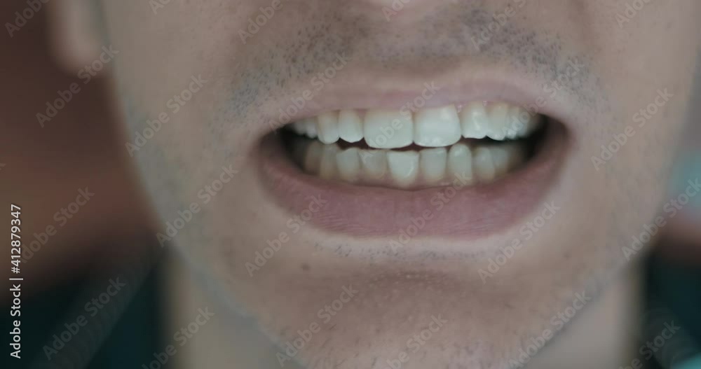 At dentist`s male patient is opening and closing his mouth, clenching