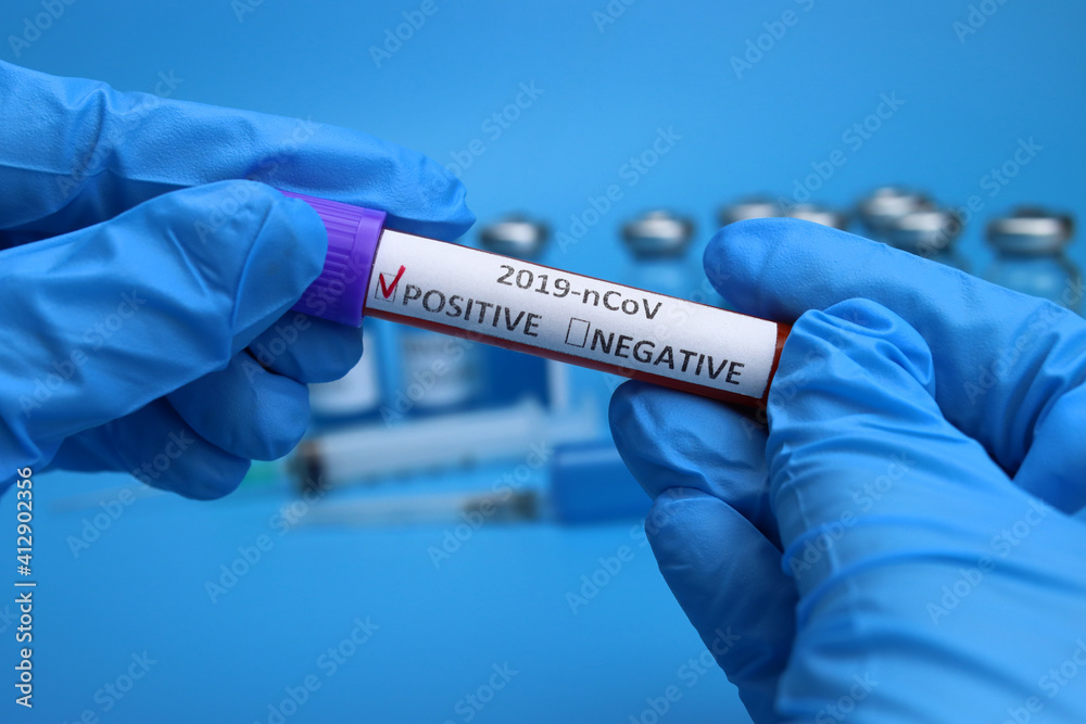 Doctor, nurse keep positive blood test for coronavirus Doctor, nurse keep positive blood test for coronavirus