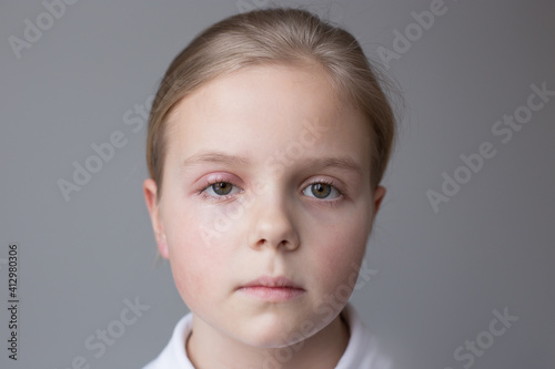Selective focus, concept. Girl 10 years old portrait. One eye has barley. Grey background.
