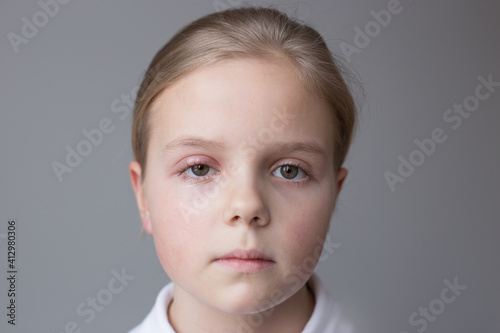 Selective focus  concept. Girl 10 years old portrait. One eye has barley. Grey background.