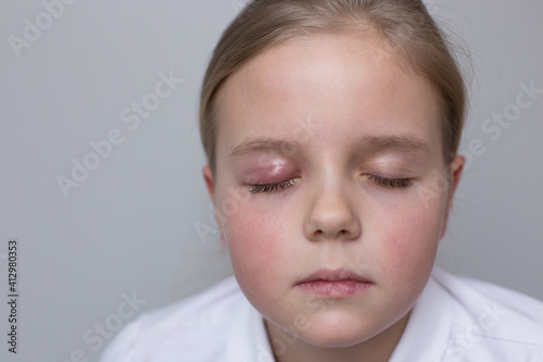 Selective focus, concept. Girl 10 years old portrait. One eye has barley. The eyes are closed. Grey background.