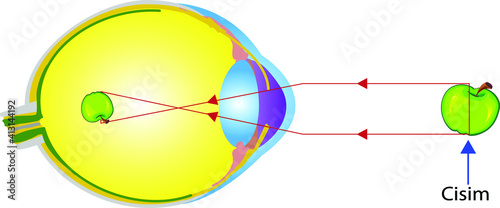 Vector Illustration of an Eye Anatomy Myopic, Online Education