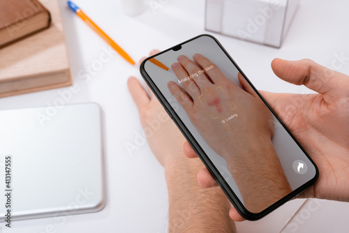 Man using a phone app to recognize skin problems on his hand