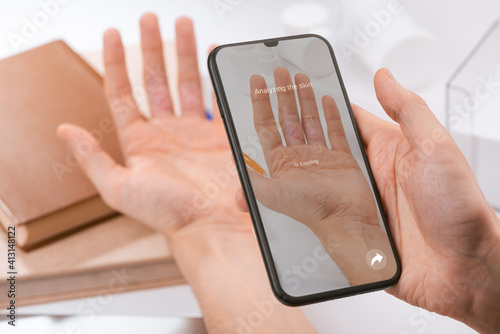 Quadro em tela Man using a phone app to recognize a disease on inner side of his fingers