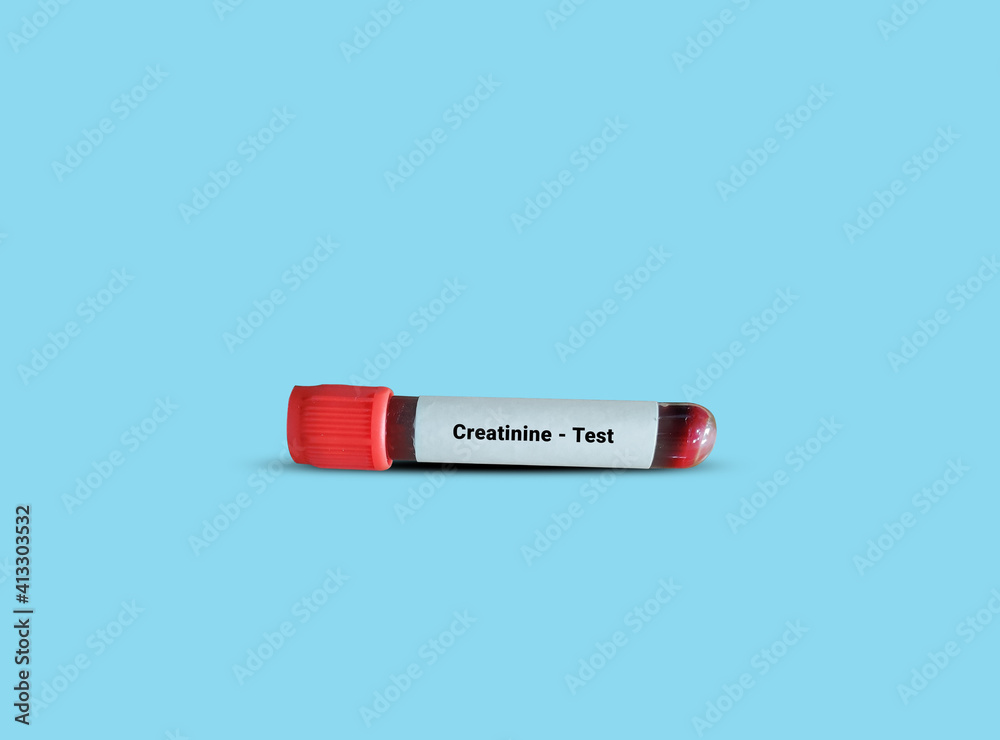Test Tube with blood sample for creatinine test. Diagnosis of kidney or