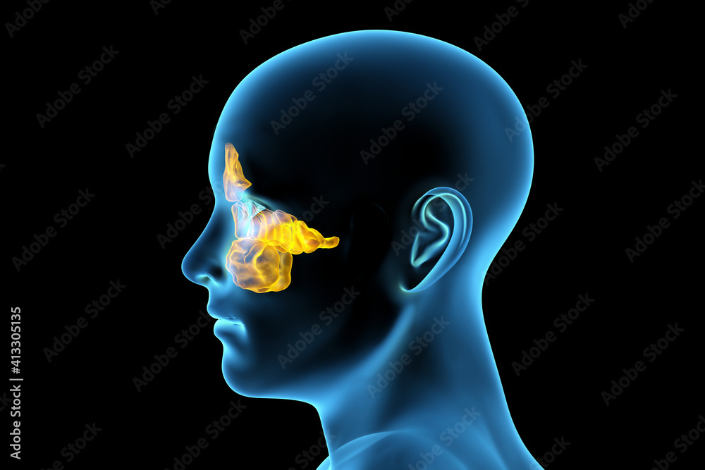 Anatomy of paranasal sinuses Anatomy of paranasal sinuses