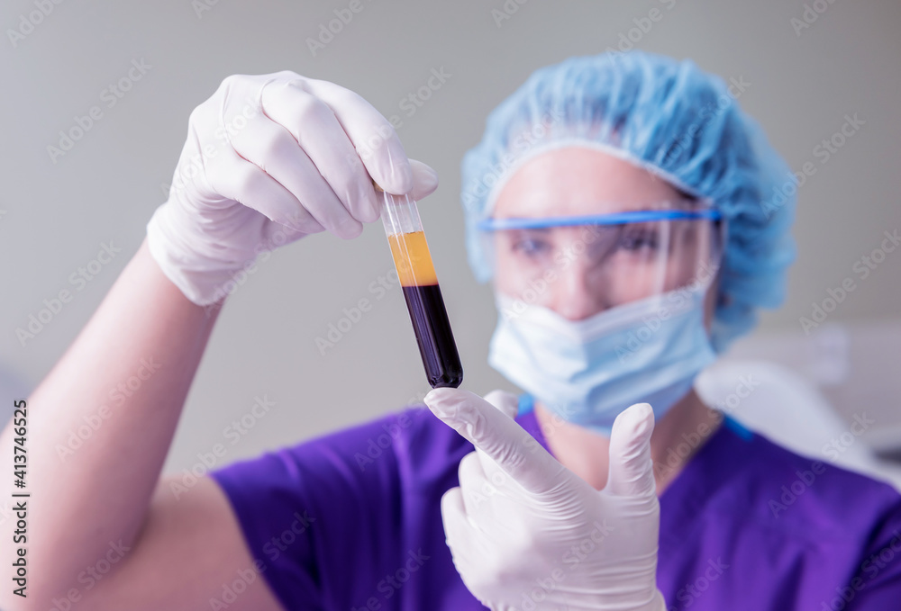 Platelet-Rich plasma preparation. Tube with plasma in hands