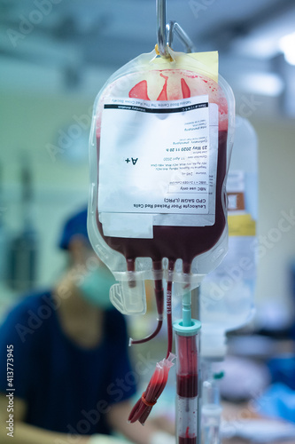 Pack red cell blood transfusion bag hanging on infusion stand in emergency or operation room in the hospital, giving to the pale patient for blood replacement and treatment of shock, acute blood loss