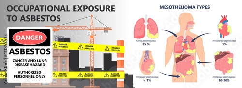 Asbestos breath chest pain testes ascites Hydrocele scrotum Swollen Difficulty fluid pleura testicle tunica vaginalis dust tract safe safety carcinogen smoking hazard danger tissue toxic silica copd