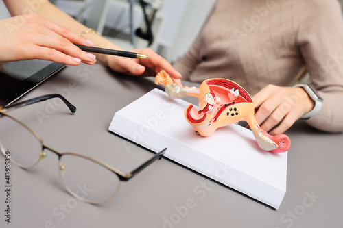 model of a human uterus in the hands of a gynecologist close-up. Women's consultation photo