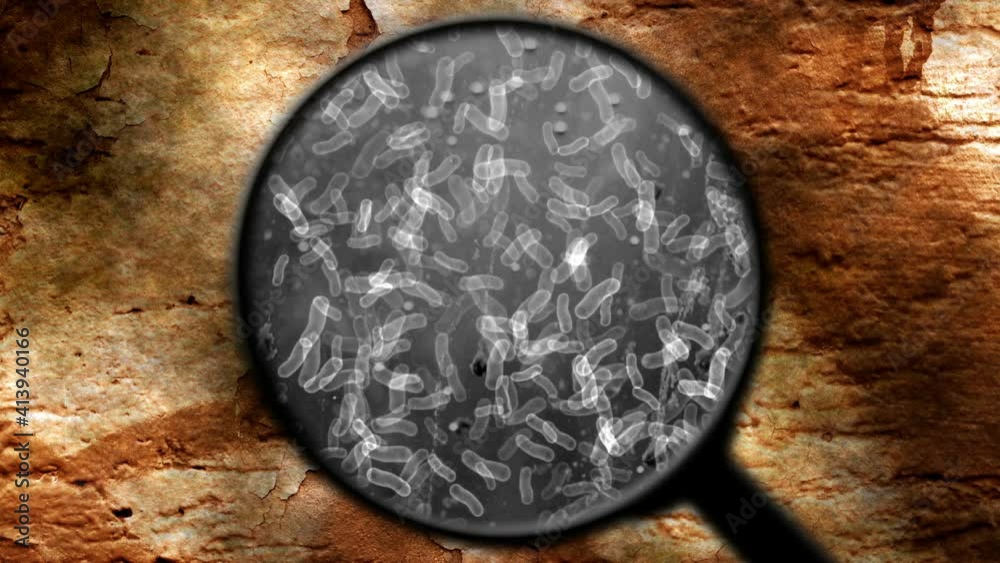 Searching for bacteria in surface Searching for bacteria in surface