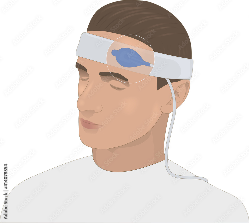 Forehead pulse oximeter, illustration. A pulse oximeter, also known as a blood oxygen meter, measures the pulse rate and oxygen concentration of the blood.