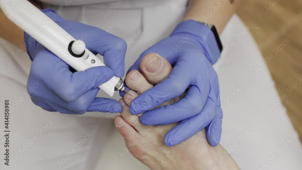 Professional hardware pedicure using an electric device. Patient on medical pedicure procedure. Podiatry clinic. Podology. Professional hardware pedicure using an electric device. Patient on medical pedicure procedure. Podiatry clinic. Podology.