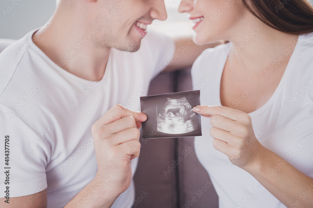 Cropped close-up view portrait of cheerful married spouses sitting on divan holding in hands x-ray shot baby new life in house flat indoor Cropped close-up view portrait of cheerful married spouses sitting on divan holding in hands x-ray shot baby new life in house flat indoor
