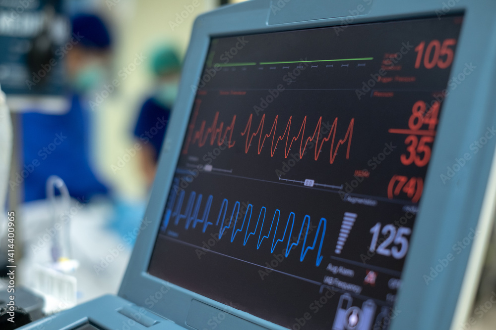 EKG monitor in intra aortic balloon pump machine. Medical equipment.