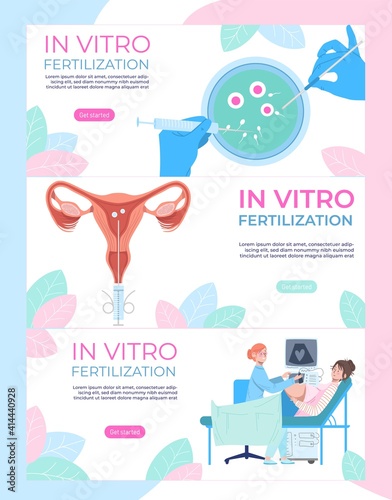 In vitro fertilization medical banners set, modern medicine, artificial pregnancy, design cartoon style vector illustration. Background information, scientific process, woman on medical examination.