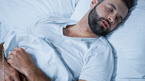 young bearded man sleeping on white bedding at home