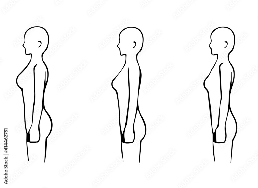 骨格診断 3タイプ 横 側面 体型イラスト ストレート ウェーブ ナチュラル Stock Vector Adobe Stock