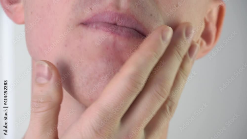 A young man strokes the skin of his face after shaving close-up in the bathroom.Facial skin care,shaving facial hair,stubble,mustache and beard.A shaved guy.Skin problems,rashes,blackheads,pimples A young man strokes the skin of his face after shaving close-up in the bathroom.Facial skin care,shaving facial hair,stubble,mustache and beard.A shaved guy.Skin problems,rashes,blackheads,pimples