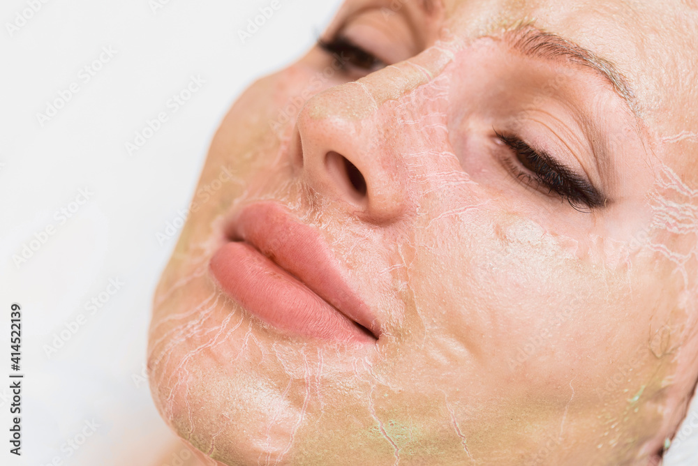 Enzyme mask in the process of drying on a woman's face close-up. Rejuvenation and facelift in cosmetology Enzyme mask in the process of drying on a woman's face close-up. Rejuvenation and facelift in cosmetology