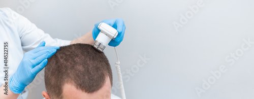 Valokuva Trichoscope examination of hair, scalp and hair follicles of a young man