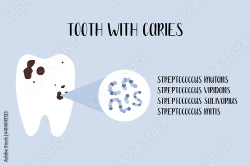 Tooth with caries. Plaque bacteria: Streptococcus mutans, Streptococcus viridans. Oral care. Dental cavity, teeth hygiene. Vector flat cartoon illustration photo