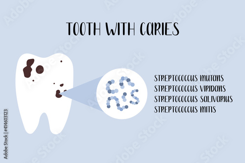 Tooth with caries. Plaque bacteria: Streptococcus mutans, Streptococcus viridans. Oral care. Dental cavity, teeth hygiene. Vector flat cartoon illustration