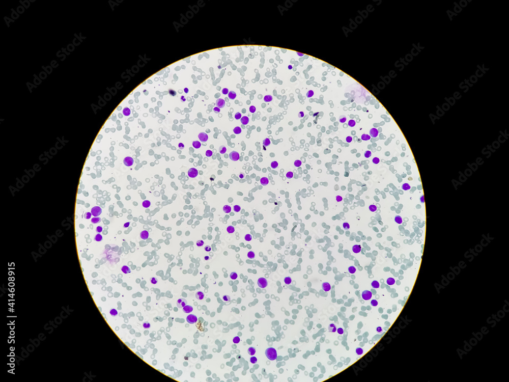 Zdjęcie Stock Blood corpuscles. Leucocytes, erythrocytes and platelets