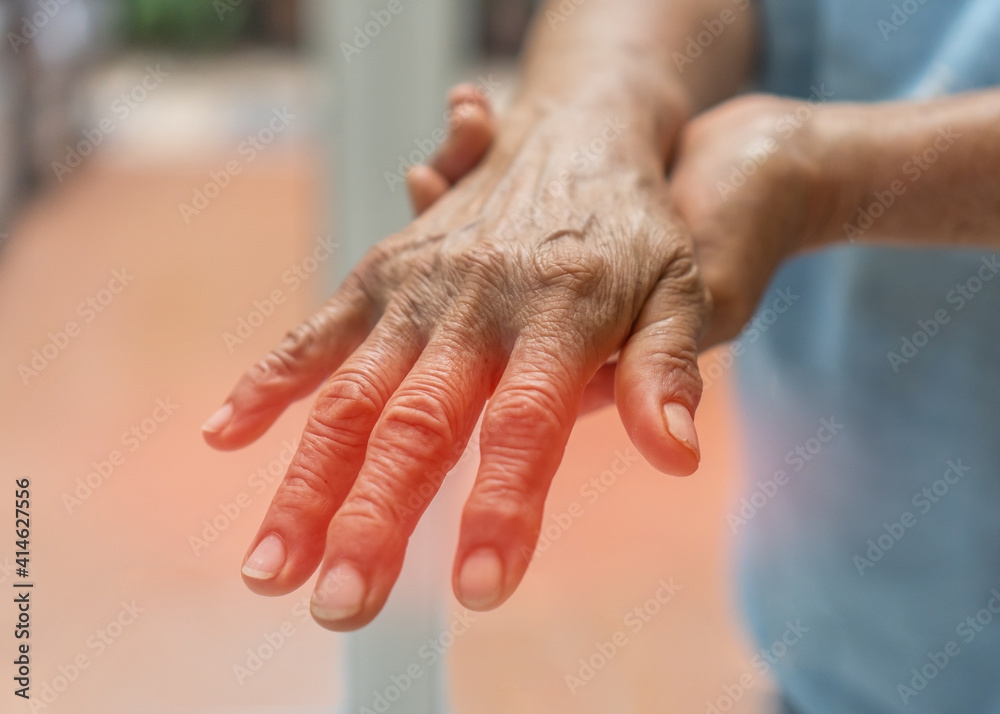 Peripheral Neuropathy pain in elderly patient on hand, palm, fingers