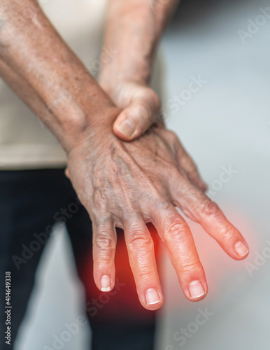 Peripheral Neuropathy pain in elderly patient on hand, palm, fingers and sensory nerves with numb, aching, muscle weakness, stabbing, burning from chronic inflammatory demyelinating polyneuropathy photo