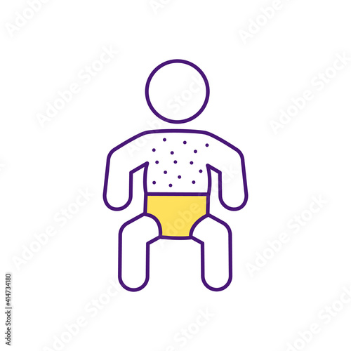 Chickenpox in babies RGB color icon. Itchy rash. Measles, psoriasis and eczema. Fever, discomfort. Aches, pains. High temperature in infants. Health condition. Baby acnes. Isolated vector illustration