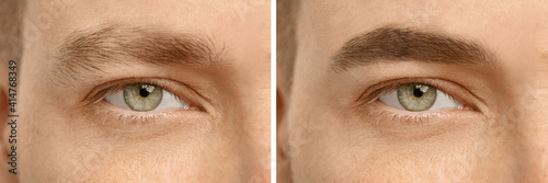 Fényképezés Collage with photos of man before and after eyebrow modeling, closeup