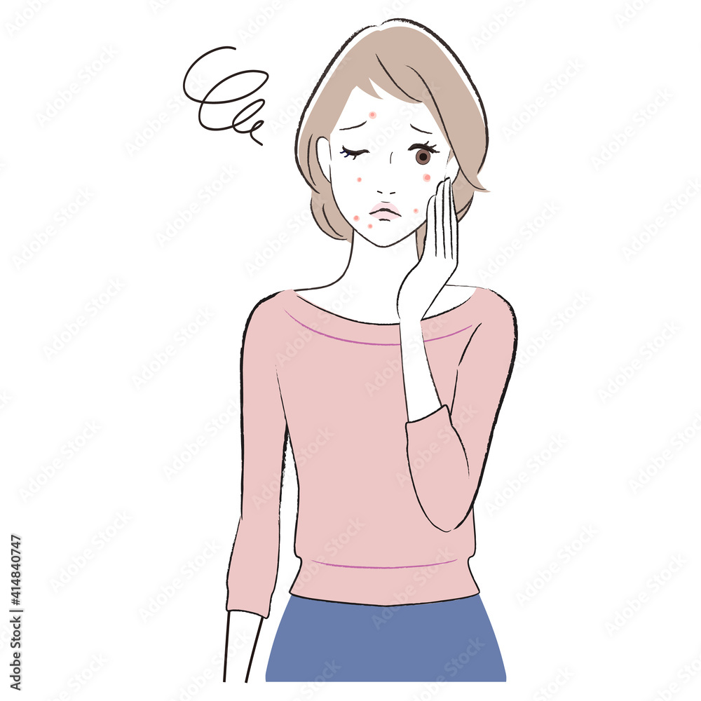 A woman having problems with facial skin