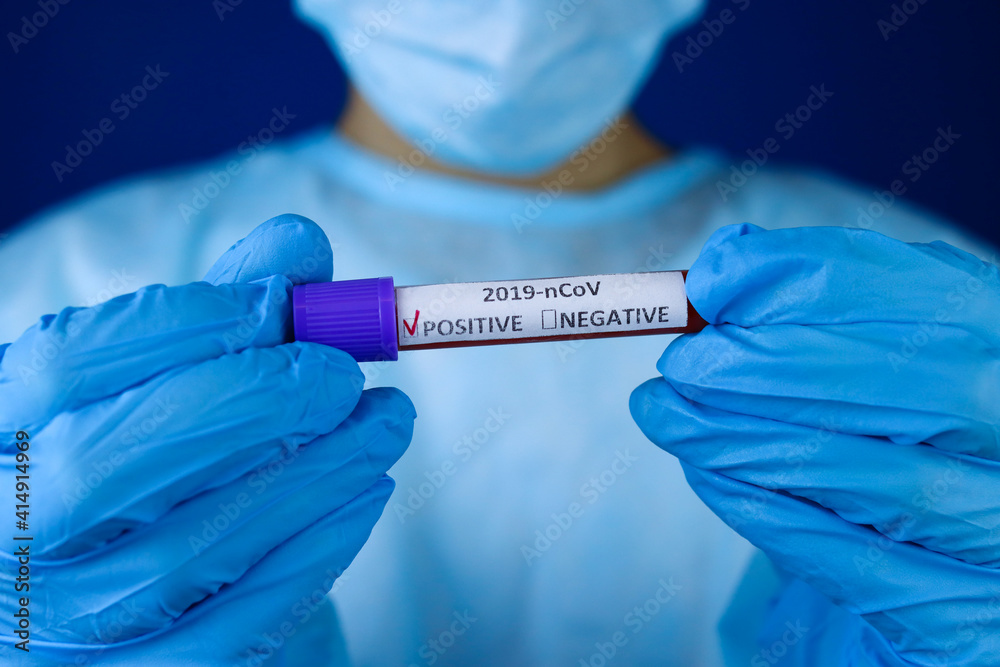 laboratory sample of blood with Positive COVID-19 test in the hands of a doctor. Selective focus laboratory sample of blood with Positive COVID-19 test in the hands of a doctor. Selective focus
