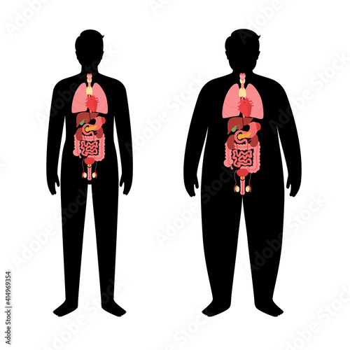 Organs in obese human body